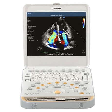Ультразвуковая диагностическая система Philips CX50_69dabe4b7a829.jpeg Ультразвуковая диагностическая система Philips CX50 — изображение 3