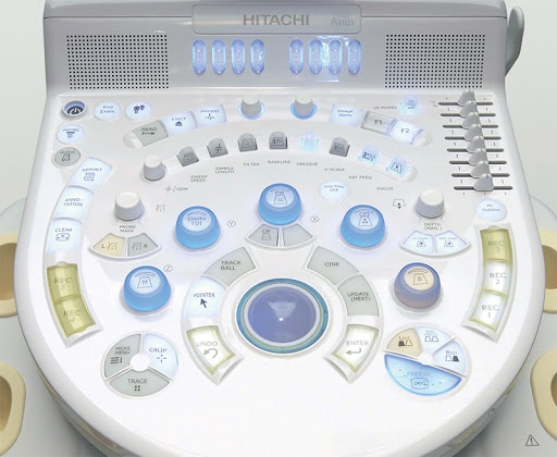 УЗИ аппарат Hitachi Hi Vision Avius_69dabd11c2fe6.jpeg УЗИ аппарат Hitachi Hi Vision Avius — изображение 2