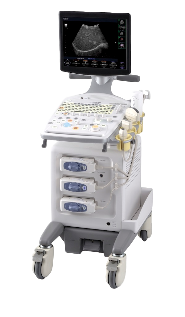 УЗИ аппарат Hitachi Prosound F37_69dabe04c2e57.png УЗИ аппарат Hitachi Prosound F37 — изображение 1