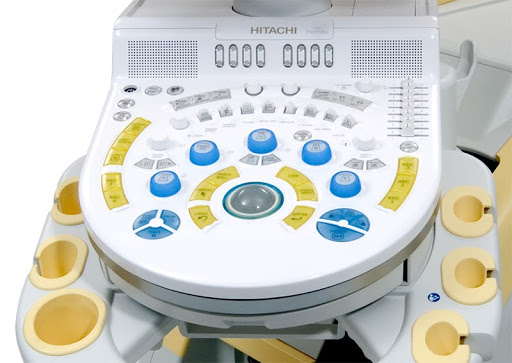 УЗИ сканер Hitachi Hi Vision Ascendus_69dabcebc714b.jpeg УЗИ сканер Hitachi Hi Vision Ascendus — изображение 2